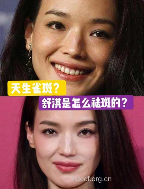 揭秘 舒淇祛斑护肤全攻略