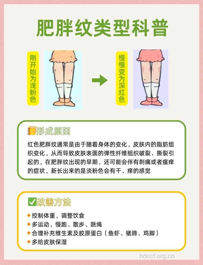 有肥胖纹很尴尬 2个方法消除肥胖纹