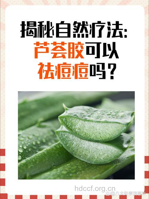 芦荟能祛痘痘吗?