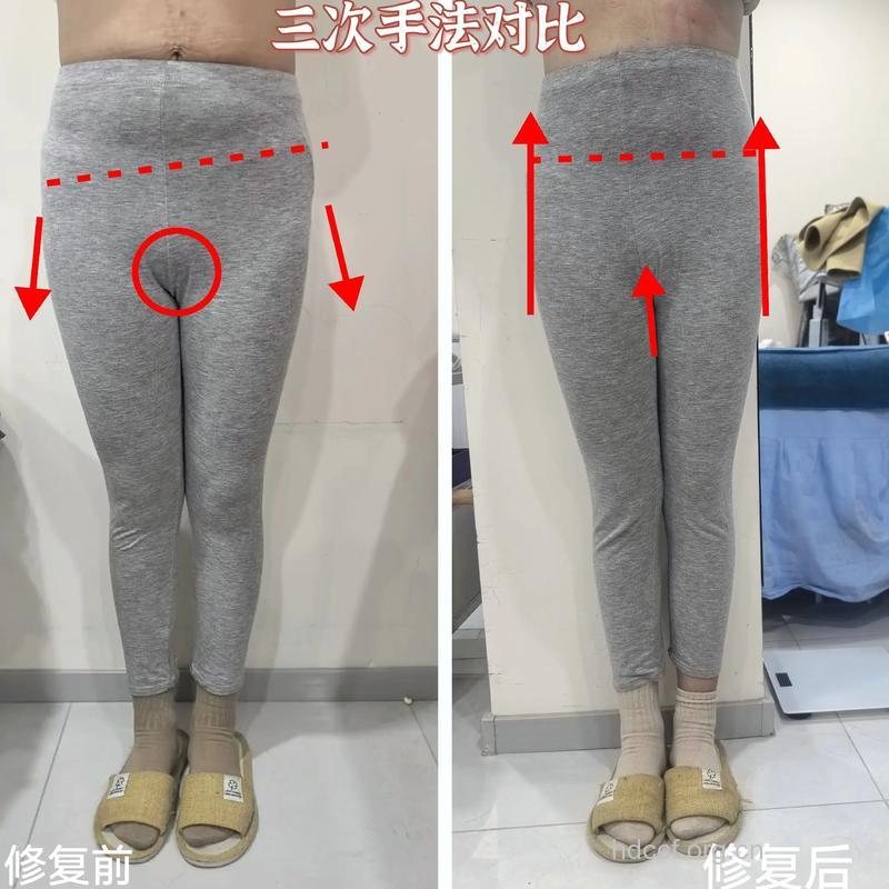 胯部越来越大 怎么才能让胯部变小