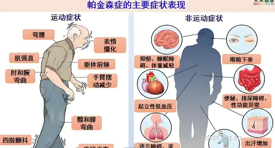 帕金森症跟用脑多少没有关系