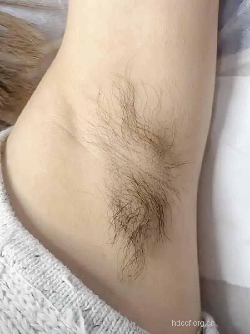 专家建议 不要频繁脱腋毛