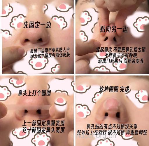 风度隆鼻贴的使用方法