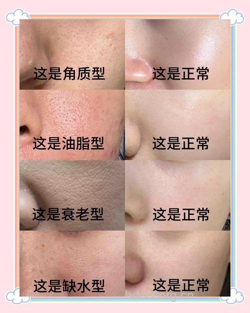 细致毛孔 立竿见影的几个小tips