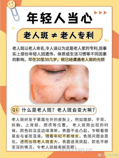 长了”老年斑”应该避免“日光晒”