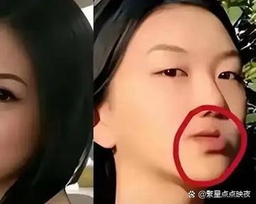看明星是这样消除
