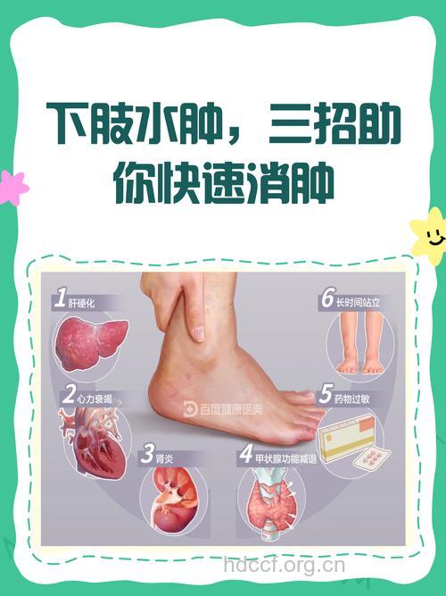 下半身浮肿怎么办 4招赶走秋季浮肿