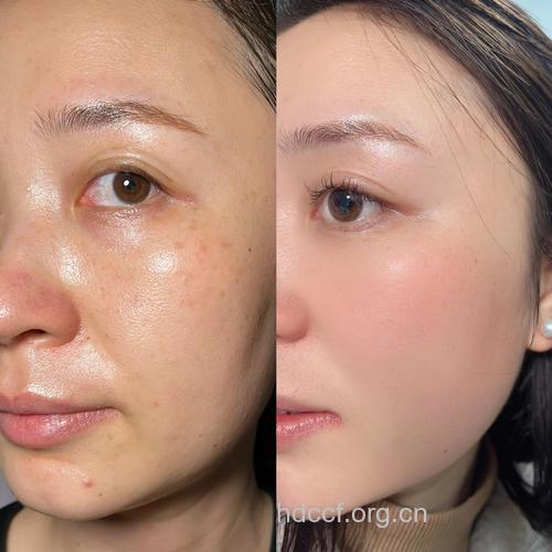 卸妆步骤错了 难怪皮肤会变差