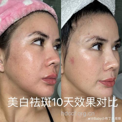 最强DIY 美白祛斑