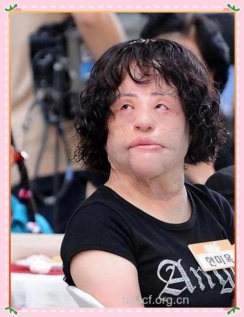 错误美丽代价的N种后果