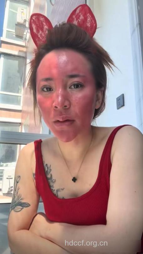 化妆不成惨遭毁容