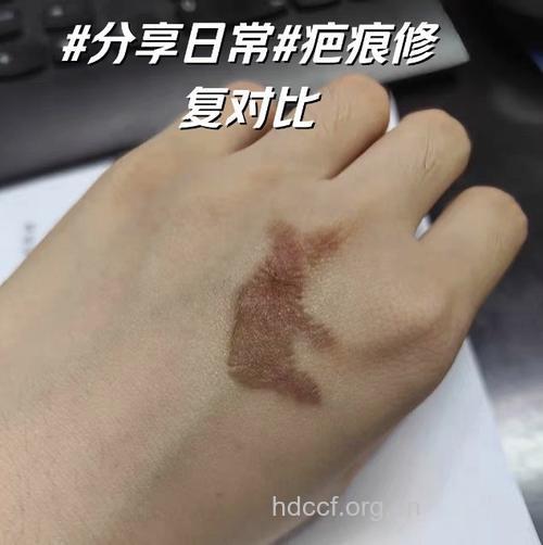 浓妆过后皮肤残 洗洗补补