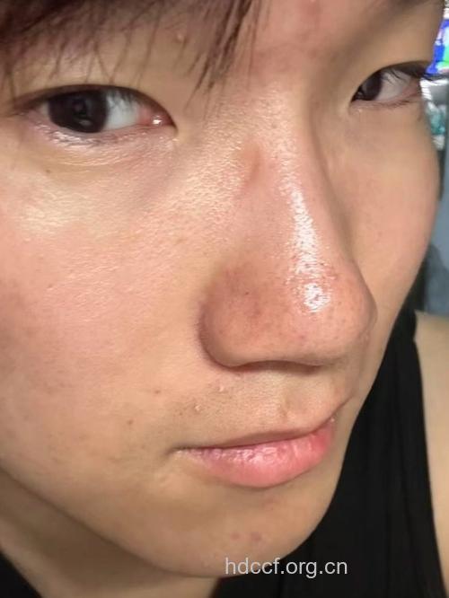 这样卸妆会让皮肤变粗糙