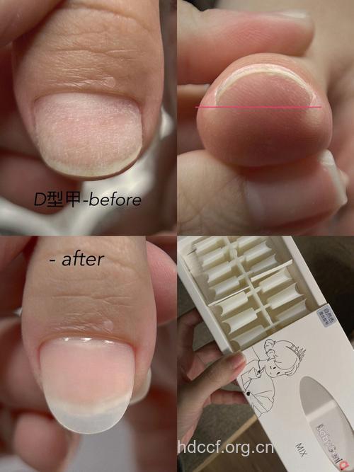 修复问题甲刻不容缓