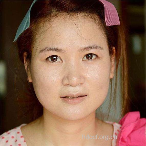 哪些坏习惯让你拥有大饼脸