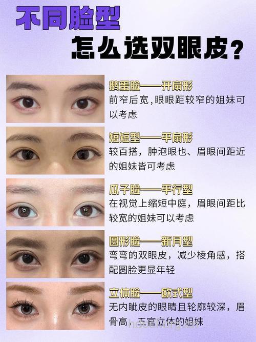 怎么让你的眼睛更有神