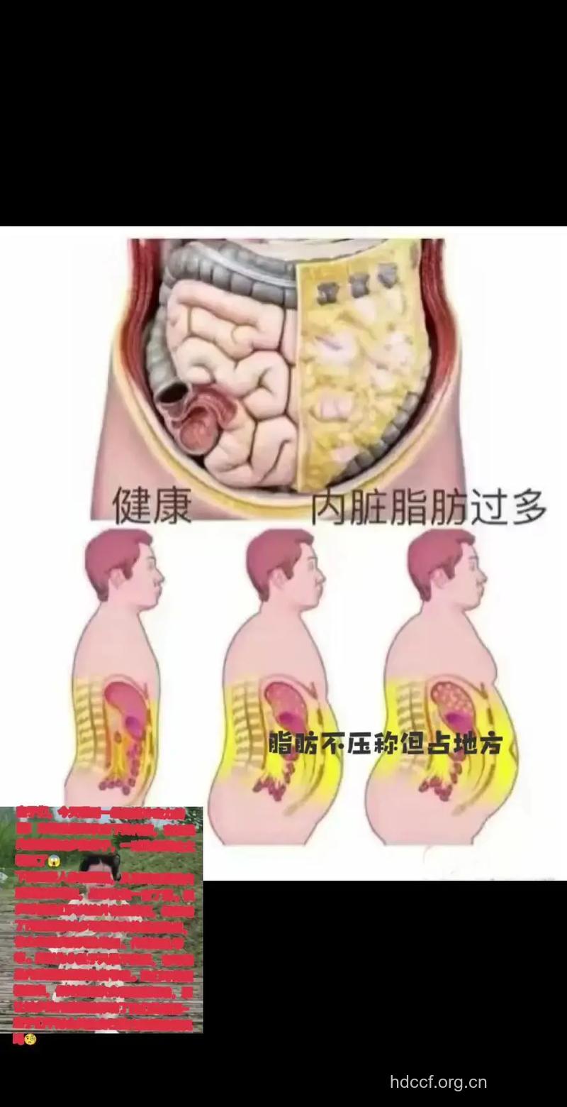 吃喝太多引起的腹部脂肪