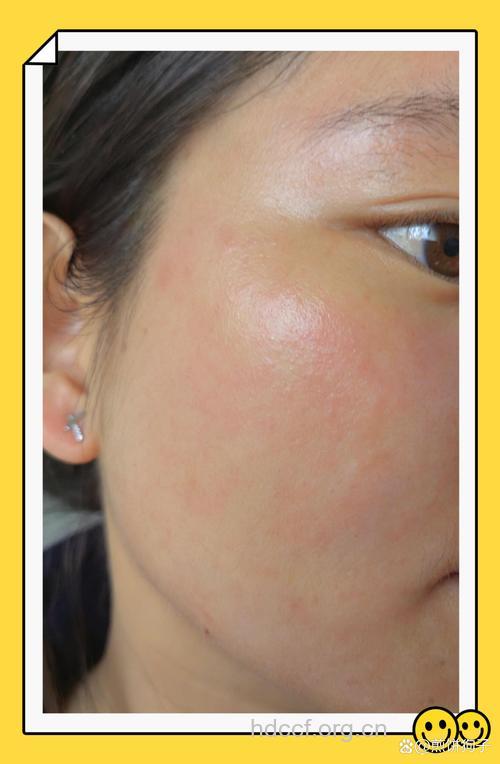 女性化妆品乱搭配易过敏