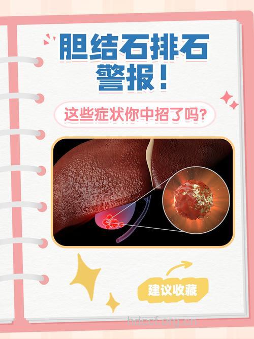 中年女性 警惕胆结石骚扰