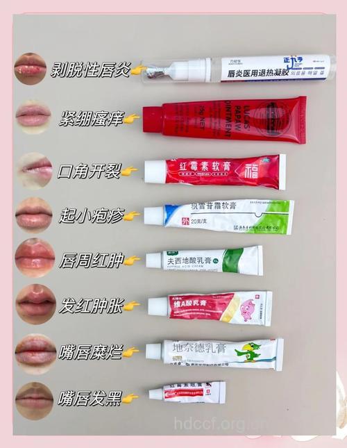 劣质唇膏易过敏 选购切莫图便宜