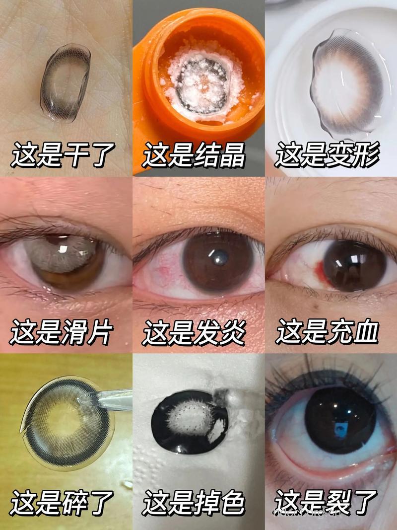戴假睫毛被刺伤角膜 劣质美眼化妆品可致癌