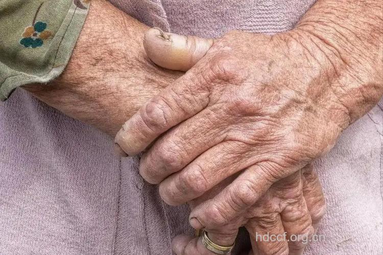 老人吃盐过多易长皱纹