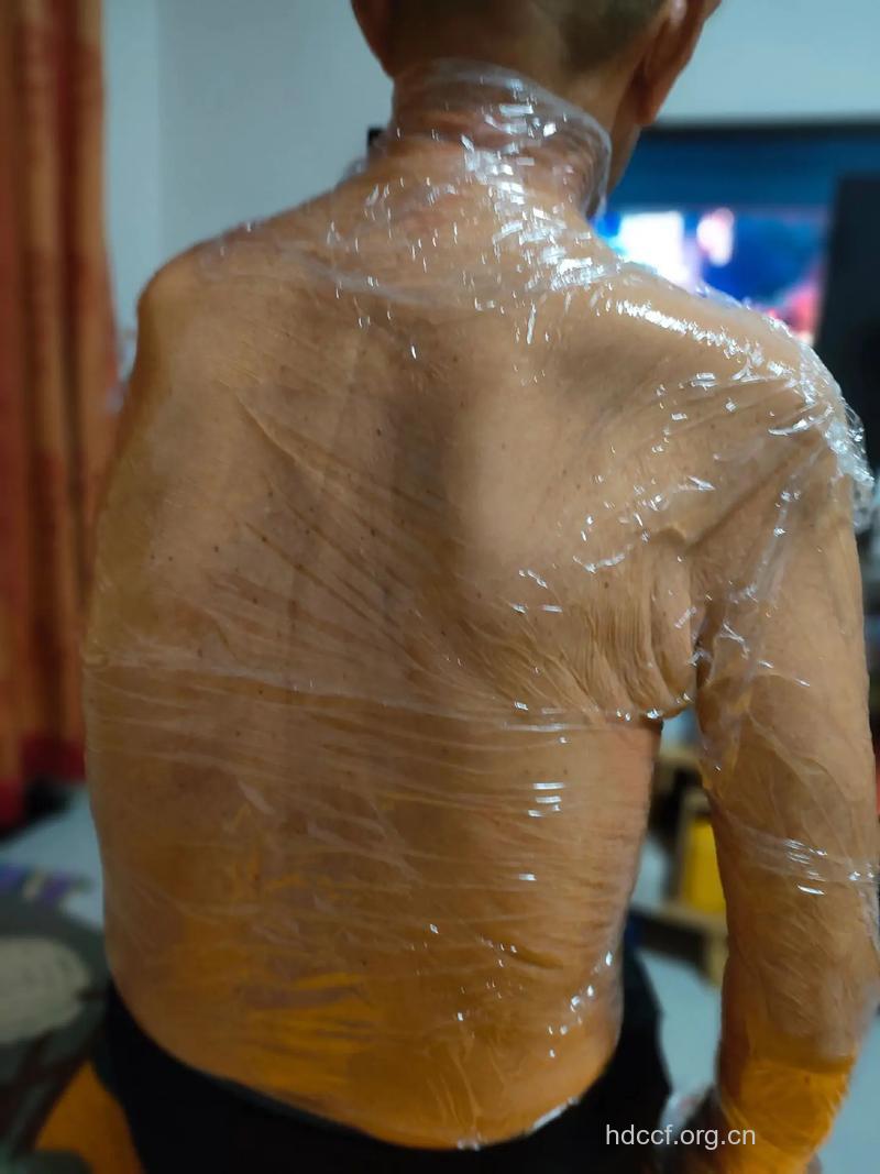 保鲜膜裹身减肥很危险