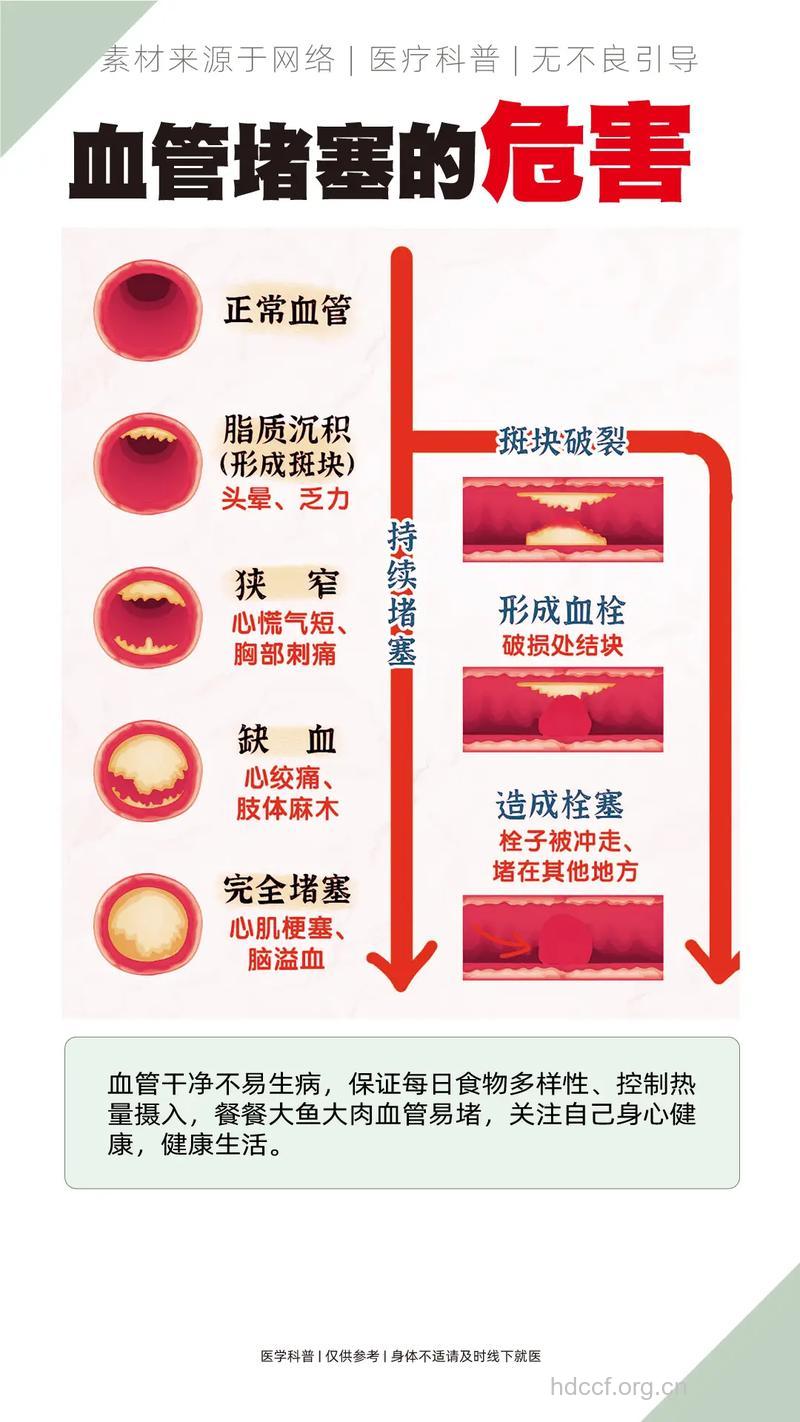 发胖为什么会引起动脉硬化