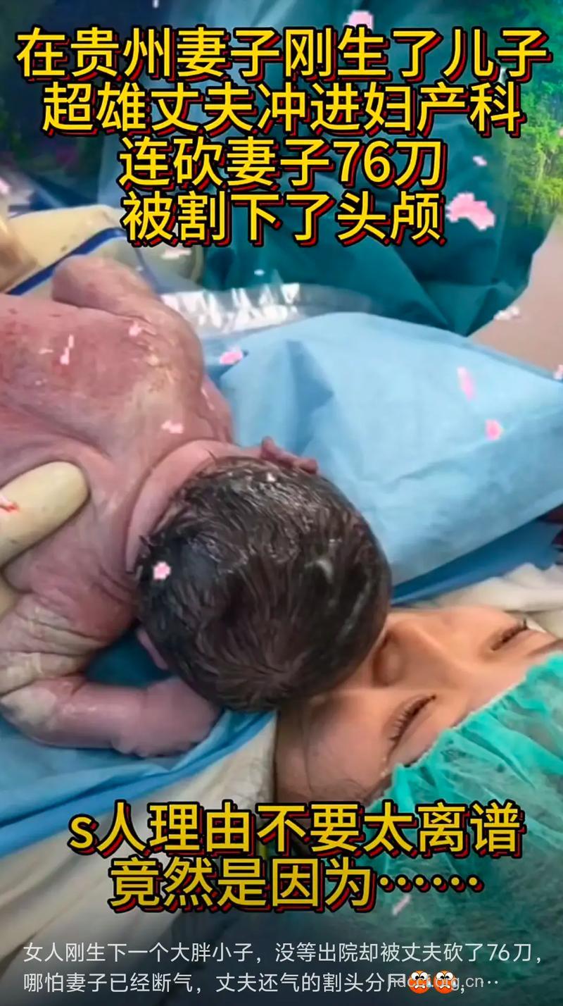 胖女人小心生出缺陷孩子