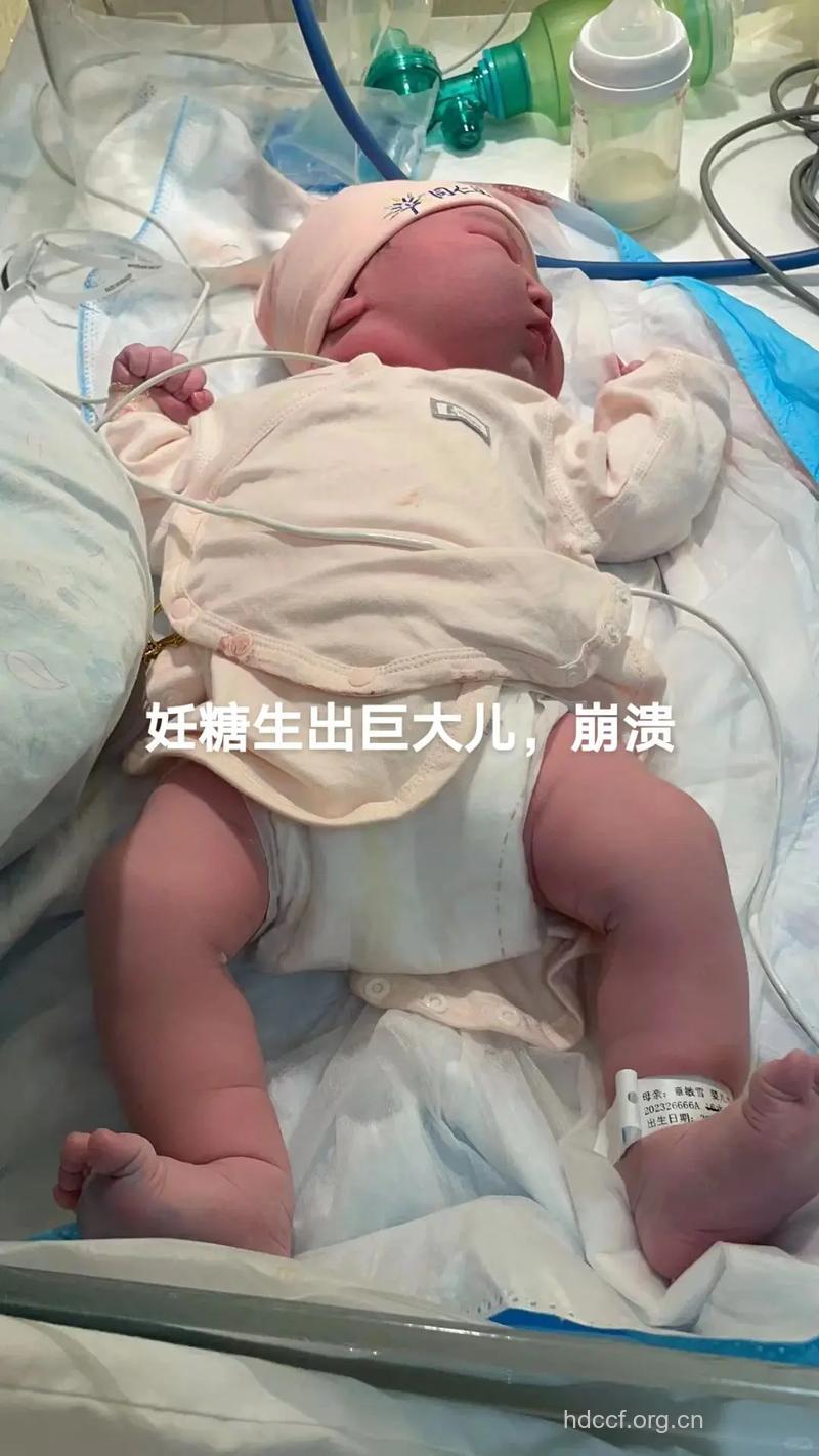 糖尿病肥胖易生出缺陷的婴儿是真的吗