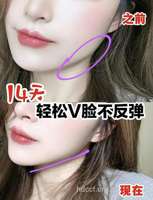 瓜子脸是怎么炼成的 快速瘦脸小窍门