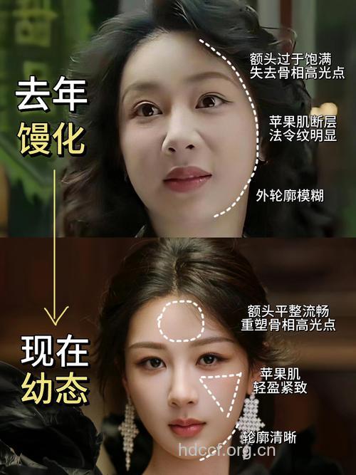 告别包子脸 精心打造动人脸型