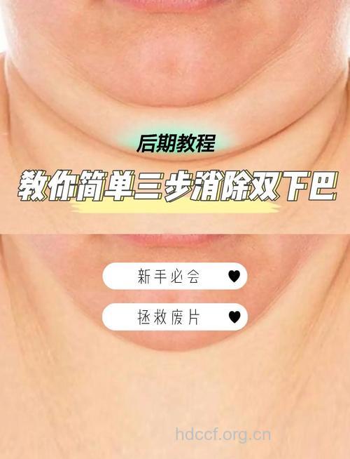 明星教你如何消灭双下巴