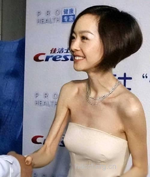 瓜子脸是这样瘦出来的