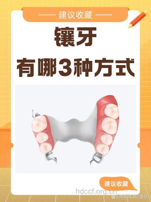 老年人镶牙时如何选择 镶牙方法各有利弊