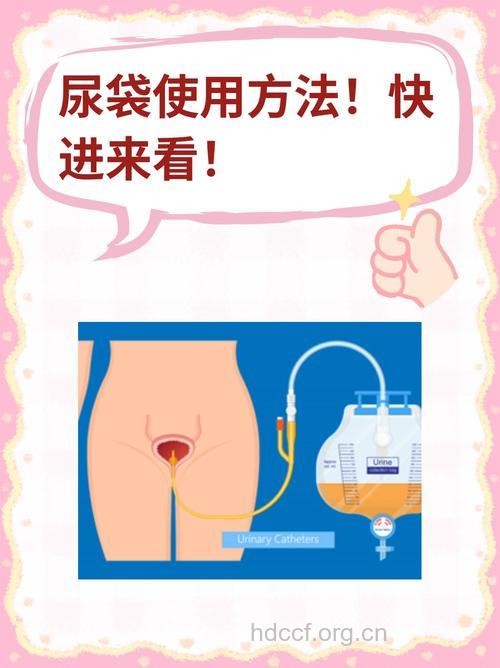 速凝尿袋有哪些作用