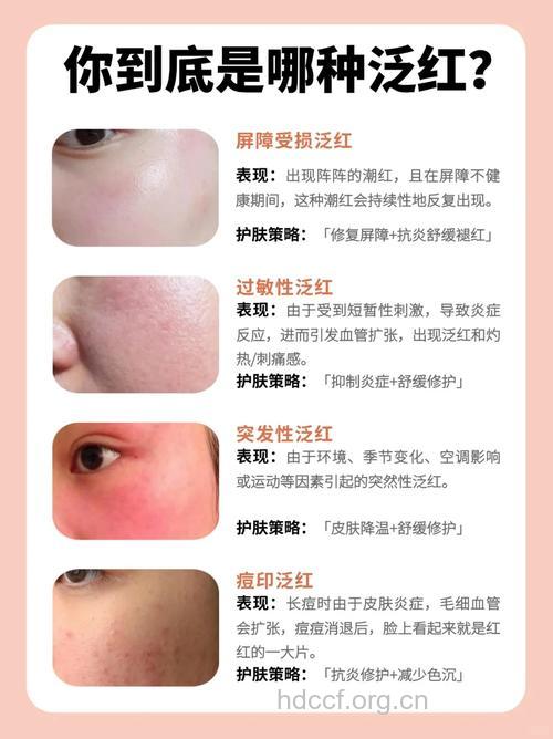 易引起面部皮肤过敏的原因