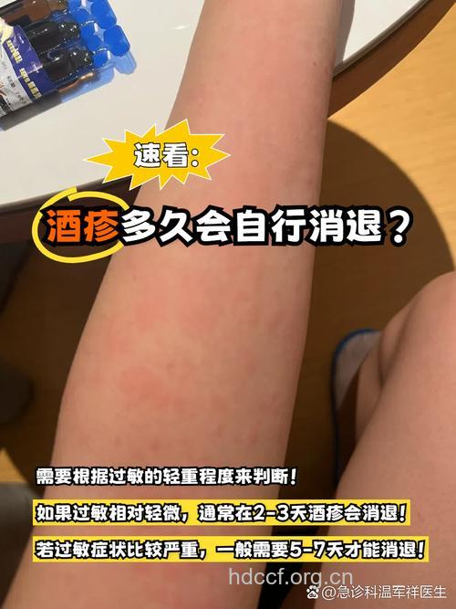 皮肤过敏的人可以喝酒吗