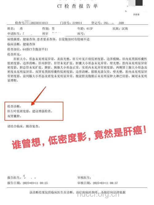 从多方面来诊断肝癌
