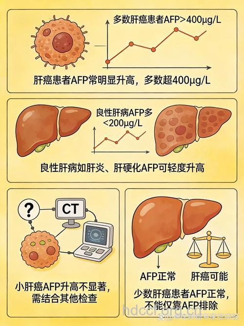 肝癌与AFP的关系