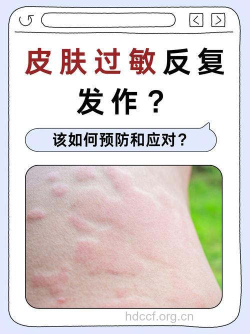 什么物品可能导致皮肤过敏