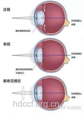 警惕:劣质老花镜伤眼睛