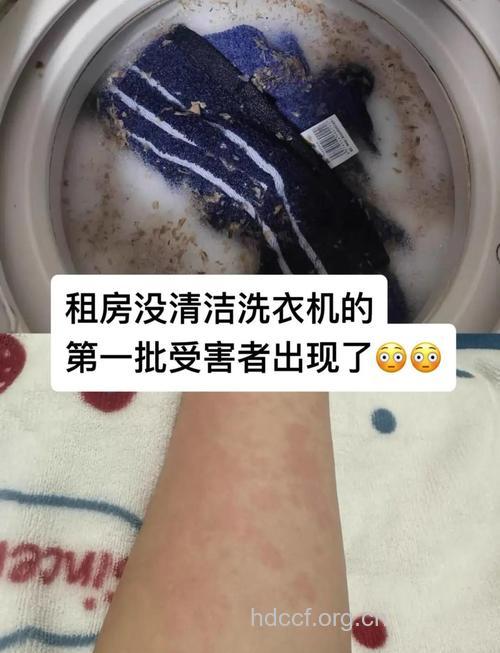 洗衣机细菌超标会引发皮肤过敏吗