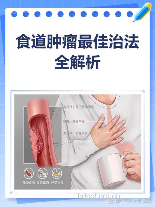 如何治疗食道癌 治疗食道癌的方法有哪些