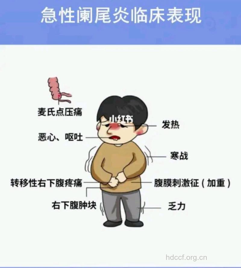 孩子肚子疼或是急性阑尾炎 急性阑尾炎症状有哪些