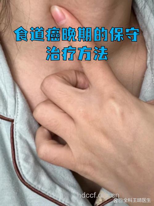 食道癌晚期能不能治愈