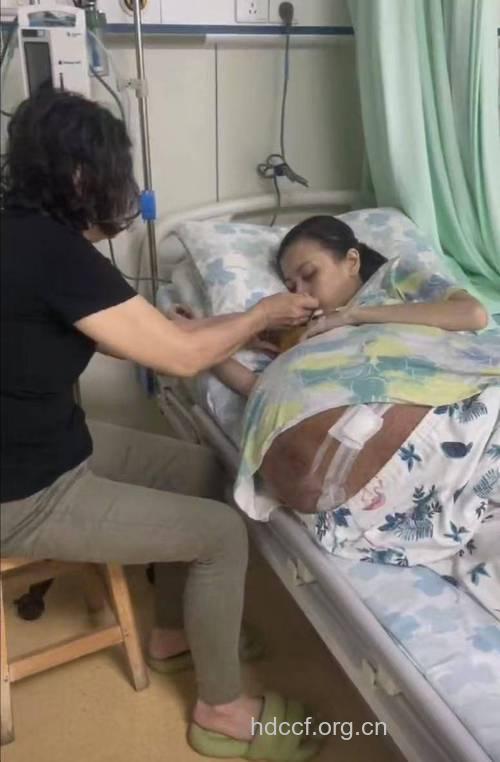 卵巢癌病人的晚期症状