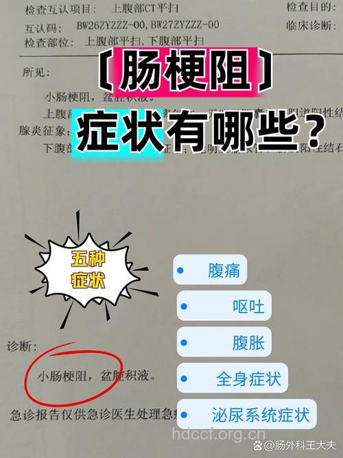 肠梗阻的典型症状及并发症