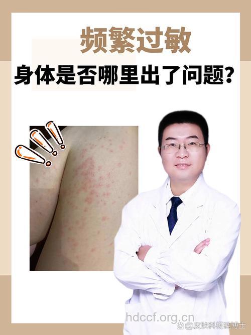 哪些物质会引起皮肤过敏