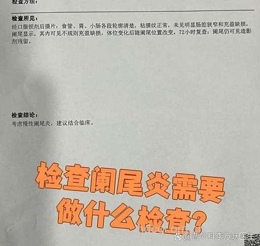 阑尾炎常见的4个检查项目